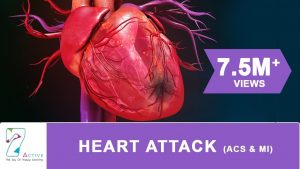 HEART ATTACK (ACS & MI)