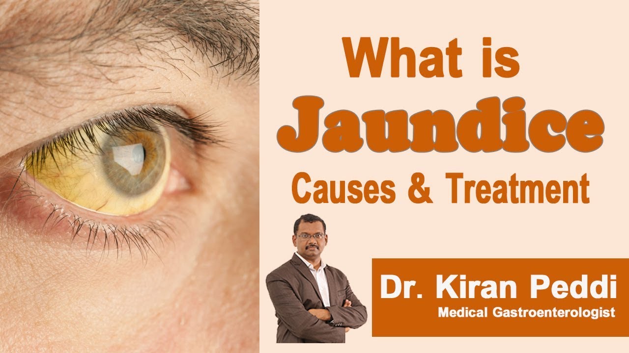 You are currently viewing Hi9 | What is Jaundice? Causes and Treatments – Dr. Kiran K Peddi ,  Medical Gastroenterologist