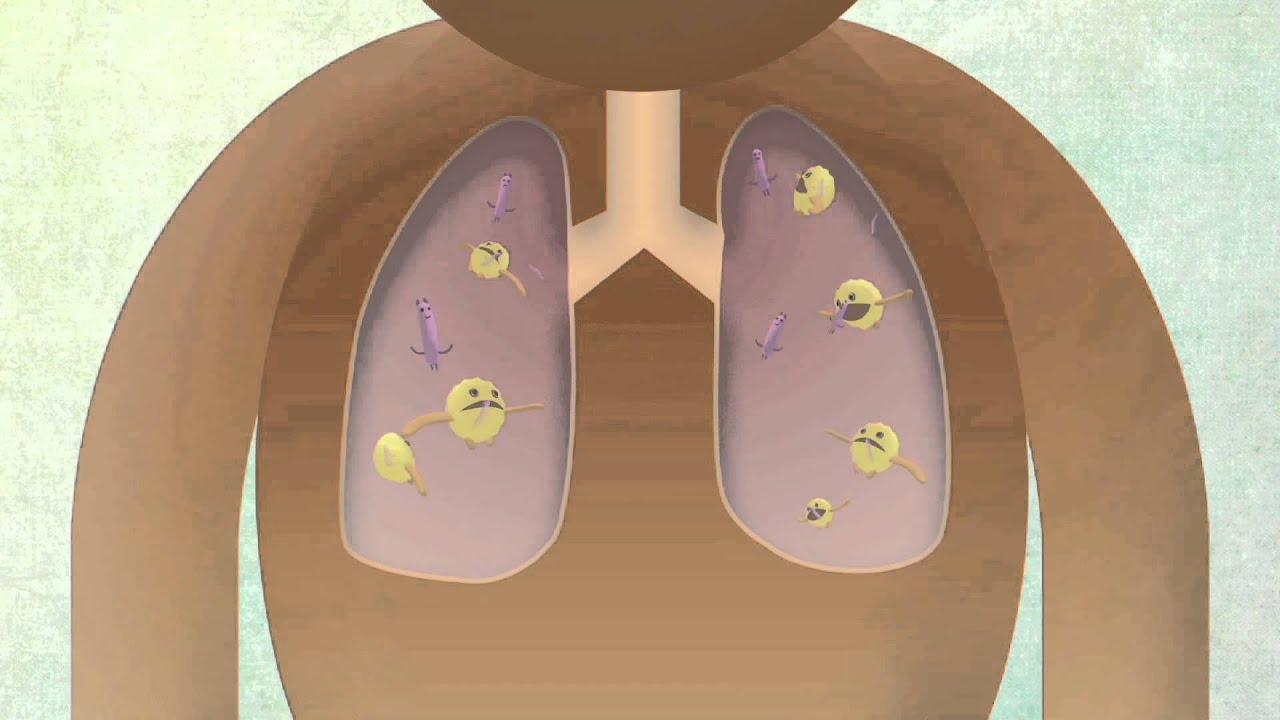 You are currently viewing How The Body Reacts To Tuberculosis