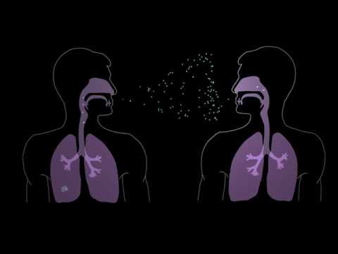 You are currently viewing How Tuberculosis Begins