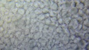 Human sperm on 1000x 1600x under a microscope