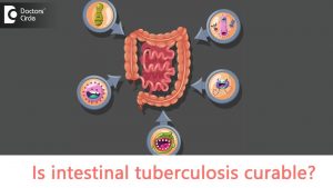 Intestinal tuberculosis – Causes, Symptoms | Is intestinal TB contagious? – Dr. Rajasekhar M R