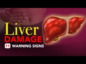 Read more about the article Liver Damage – 11 Warning Signs