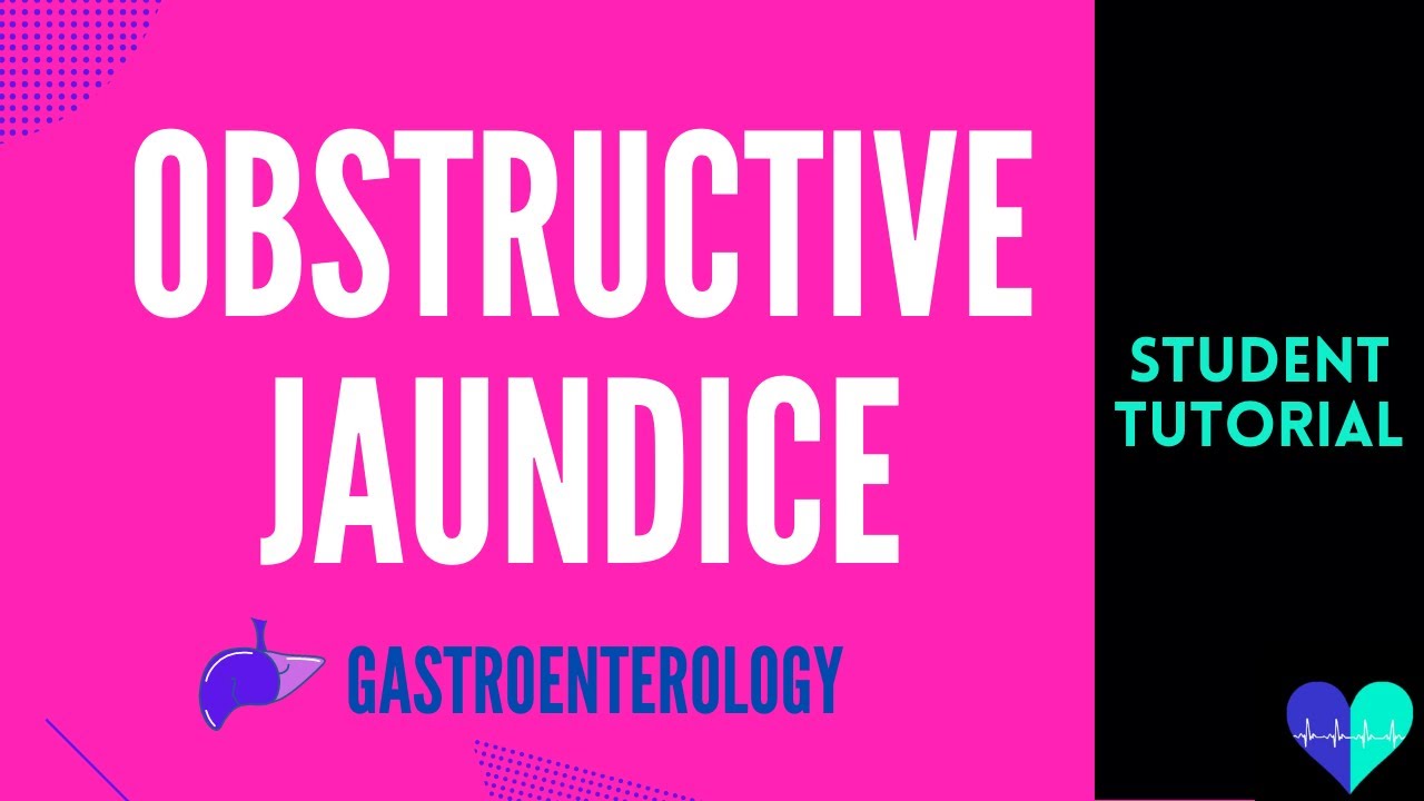 You are currently viewing Obstructive Jaundice – Medical Tutorial