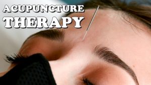 Relaxing Acupuncture Treatment To Relieve Stress