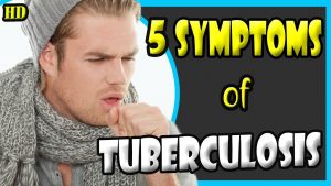 Read more about the article TUBERCULOSIS Signs and Symptoms