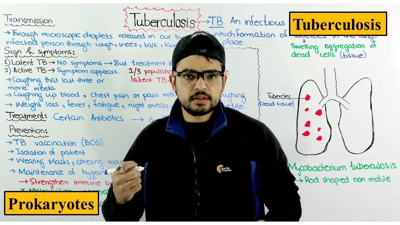 You are currently viewing Tuberculosis (TB) | Causes, Treatment, Prevention and Transmission | Prokaryotes