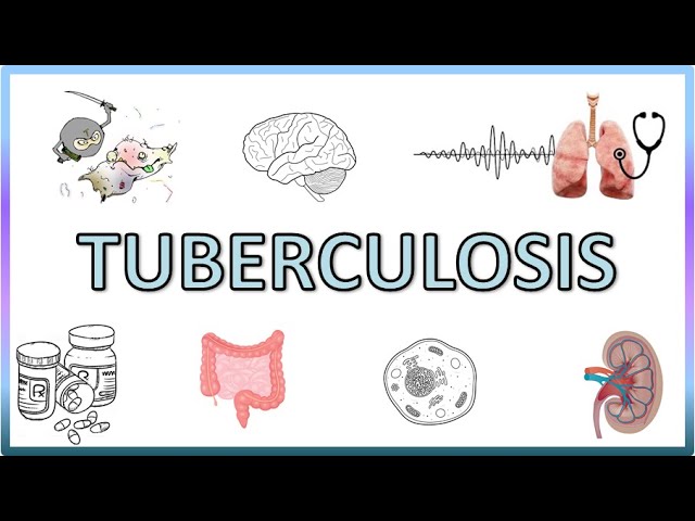 You are currently viewing Tuberculosis – Types, Pathogenesis, Signs and Symptoms, Diagnosis, Treatment and Prevention