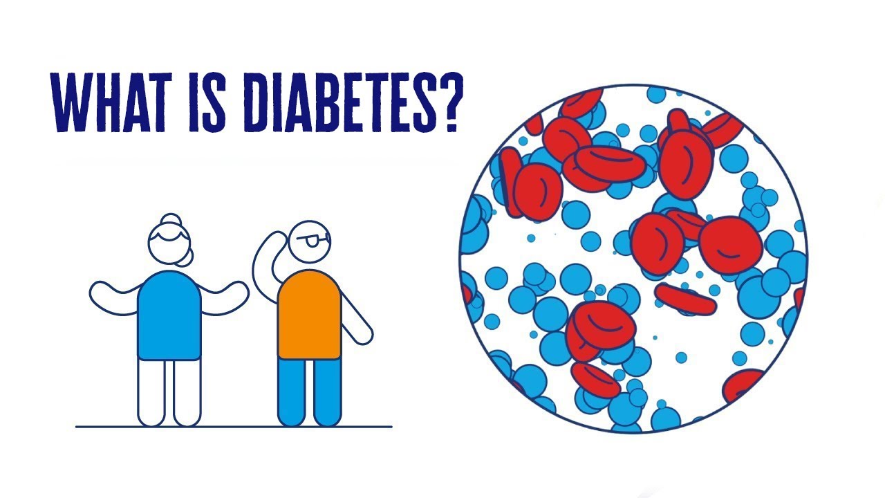 You are currently viewing What Is Diabetes? | 2 Minute Guide | Diabetes UK