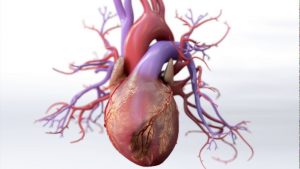 What is Coronary Artery Disease – Mechanism of Disease