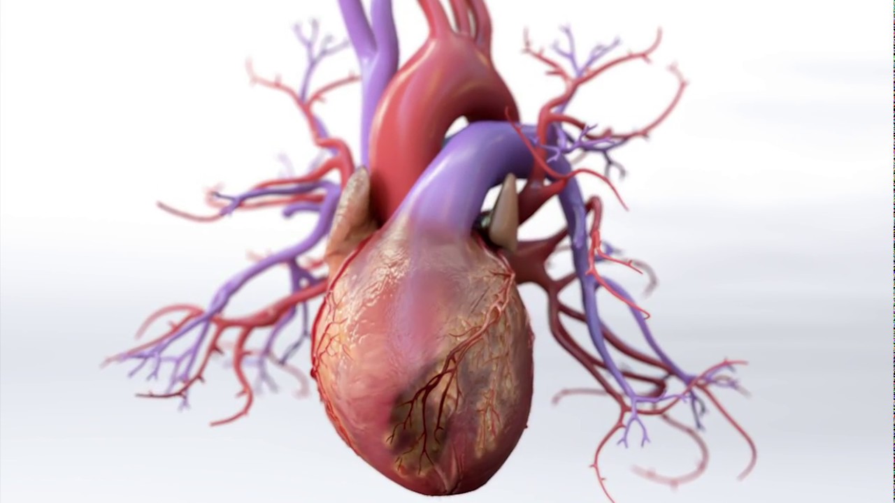 You are currently viewing What is Coronary Artery Disease – Mechanism of Disease