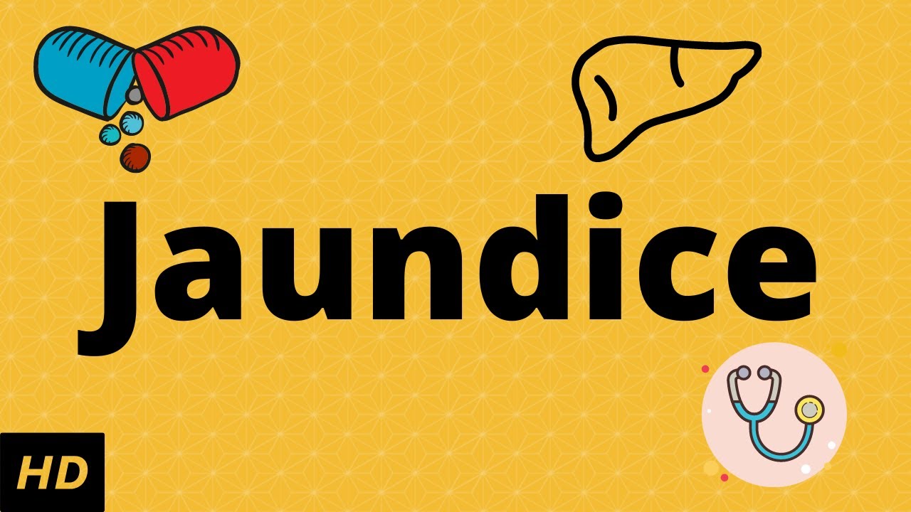 You are currently viewing What is Jaundice?Causes, Signs and symptoms, Diagnosis and treatment