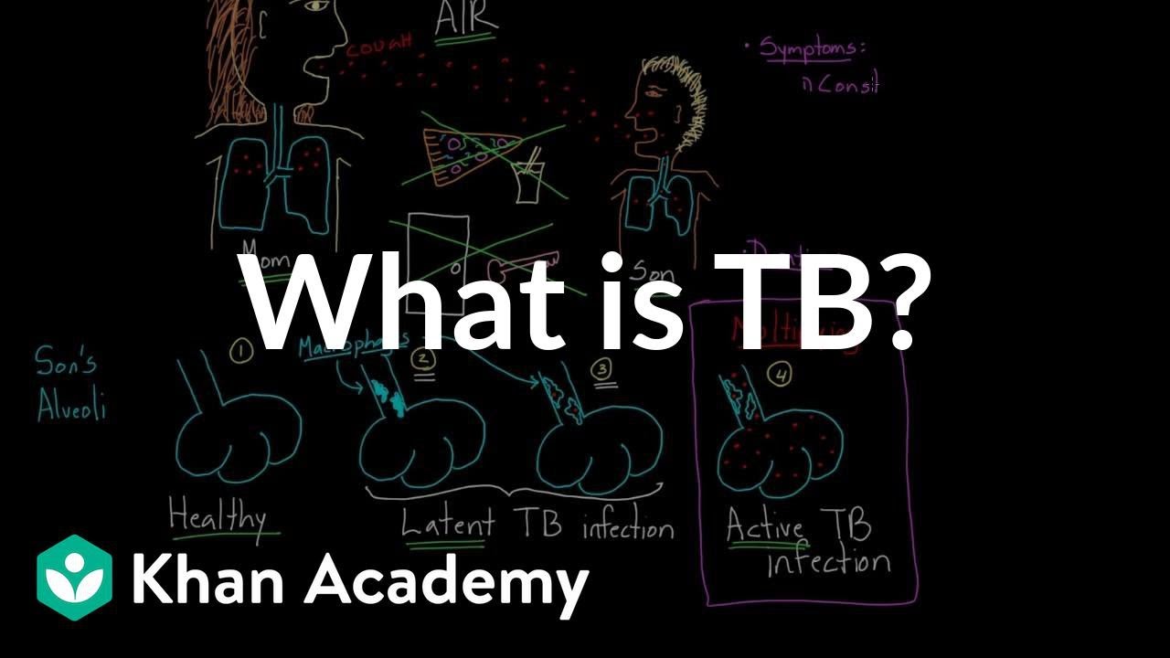 You are currently viewing What is TB? | Infectious diseases | NCLEX-RN | Khan Academy