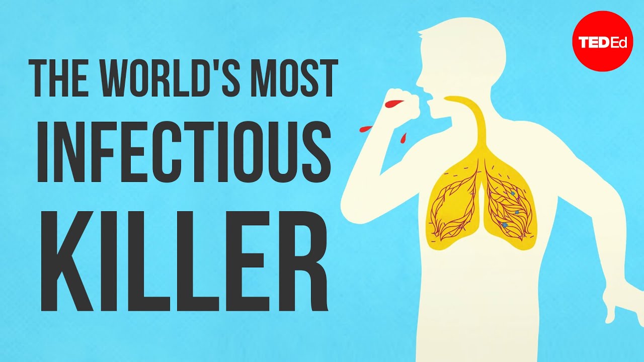 You are currently viewing What makes tuberculosis (TB) the world’s most infectious killer? – Melvin Sanicas