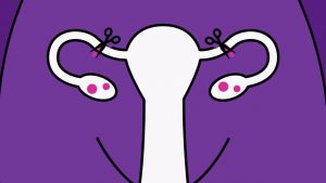 Brook Contraception – Sterilisation Animation