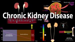 Chronic Kidney Disease, Animation