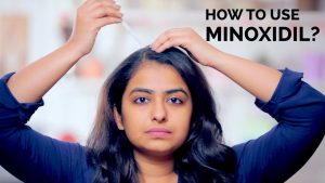 How To Use Minoxidil | Hair Regrowth | Skin Diaries