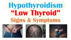 Hypothyroidism Signs & Symptoms | & Why Symptoms Occur