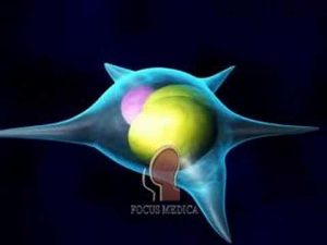 Insulin Resistance