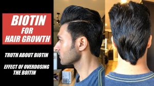 Is BIOTIN for Hair Growth? What if you Overdose the Biotin – Info by Guru Mann