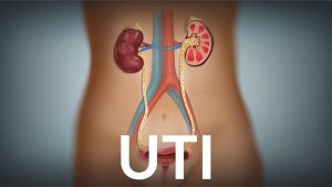 “Urinary Tract Infection” by Elizabeth Pingree for OPENPediatrics