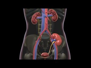 What Is a Kidney Transplant?