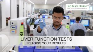 What your Liver Function Test results can show